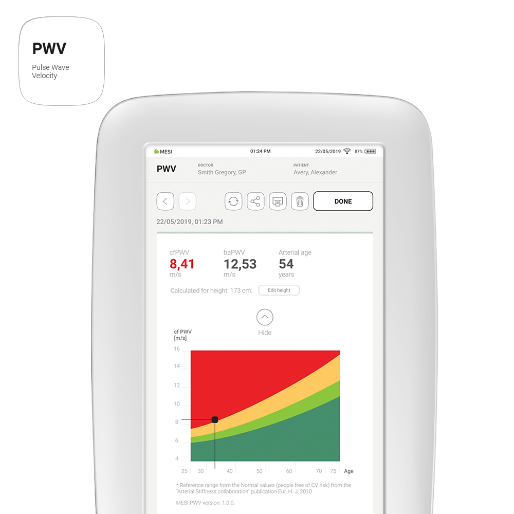 MESI app Pulse Wavelength Velocity