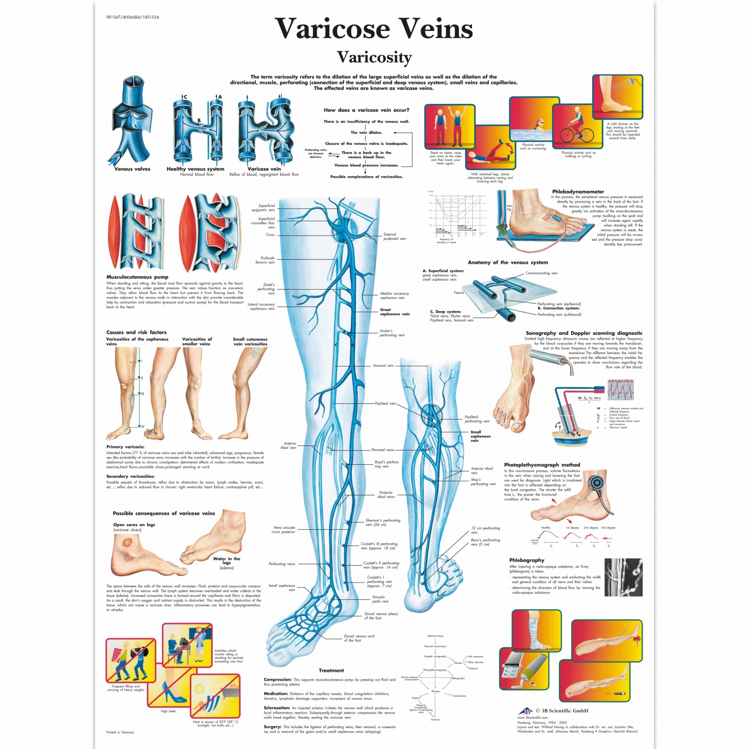 Pancarte murale plastifiée Varicose Veins - 50 x 67 cm