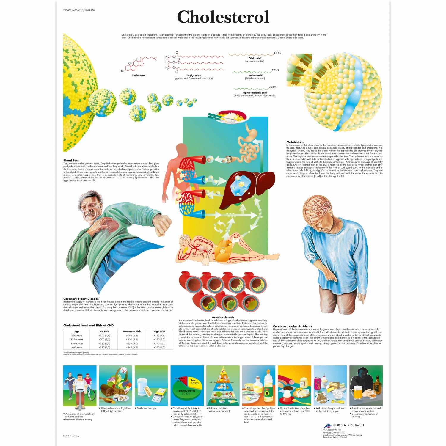 Pancarte murale plastifiée Cholesterol - 50 x 67 cm