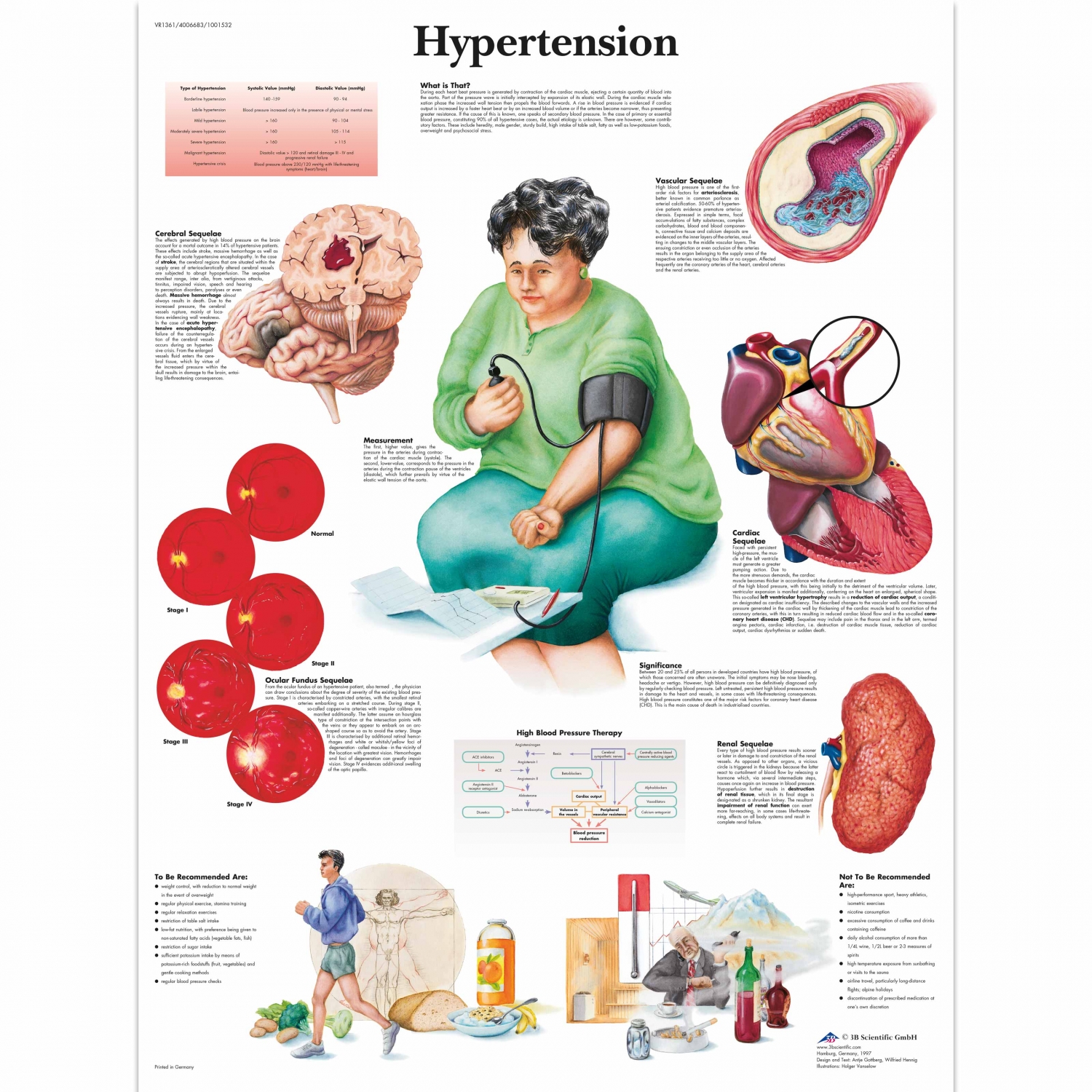 Pancarte murale plastifiée Hypertension - 50 x 67 cm