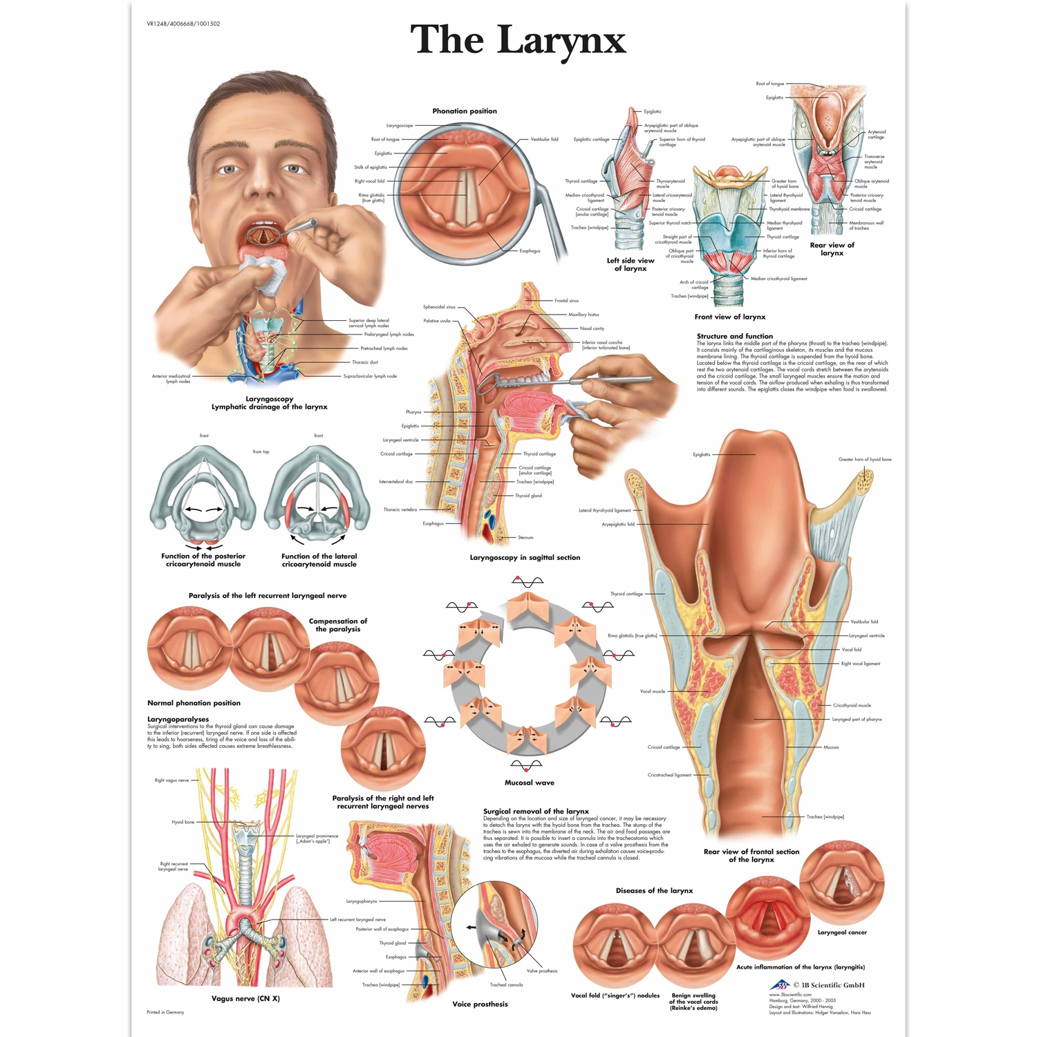 Wandplaat geplastificeerd The Larynx - 50 x 67 cm