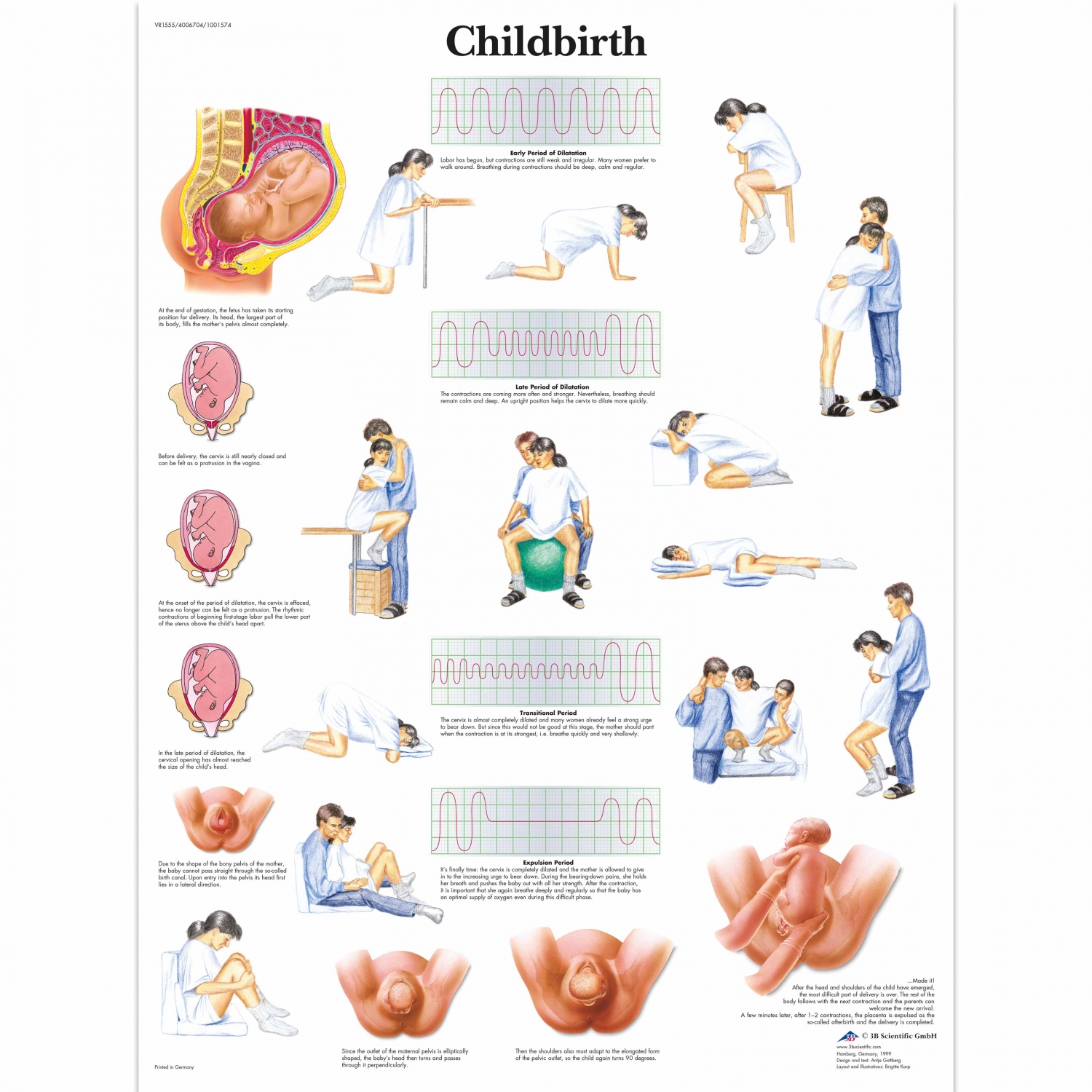 Pancarte murale plastifiée Childbirth - 50 x 67 cm