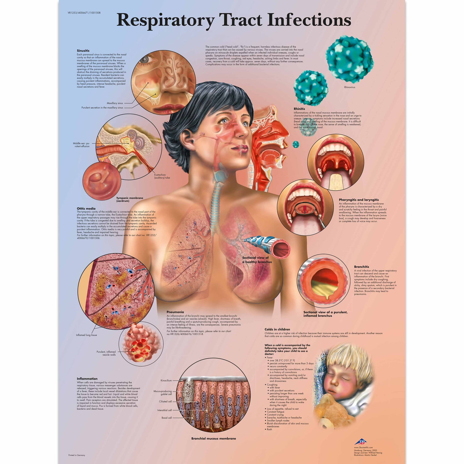Wandplaat geplastificeerd Respiratory Tract Infections - 50 x 67 cm