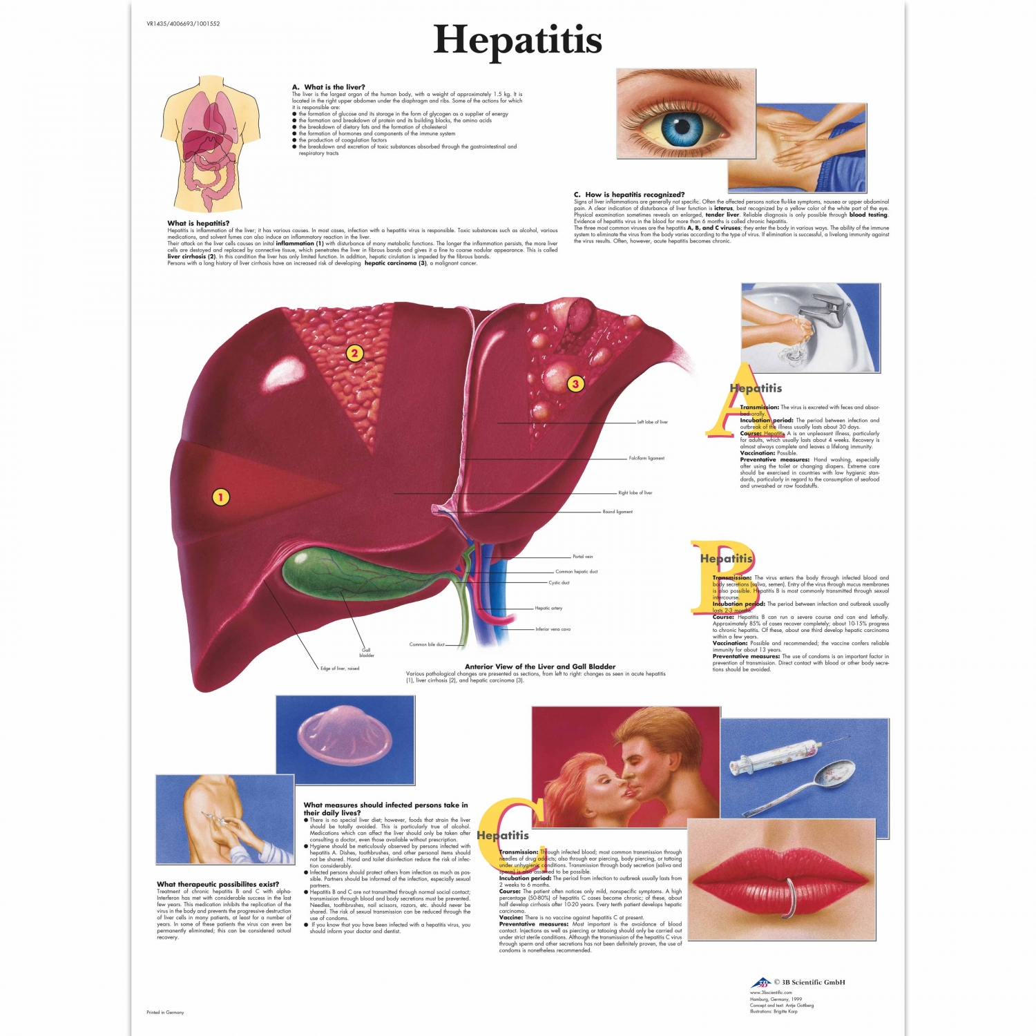 Wandplaat geplastificeerd Hepatits - 50 x 67 cm