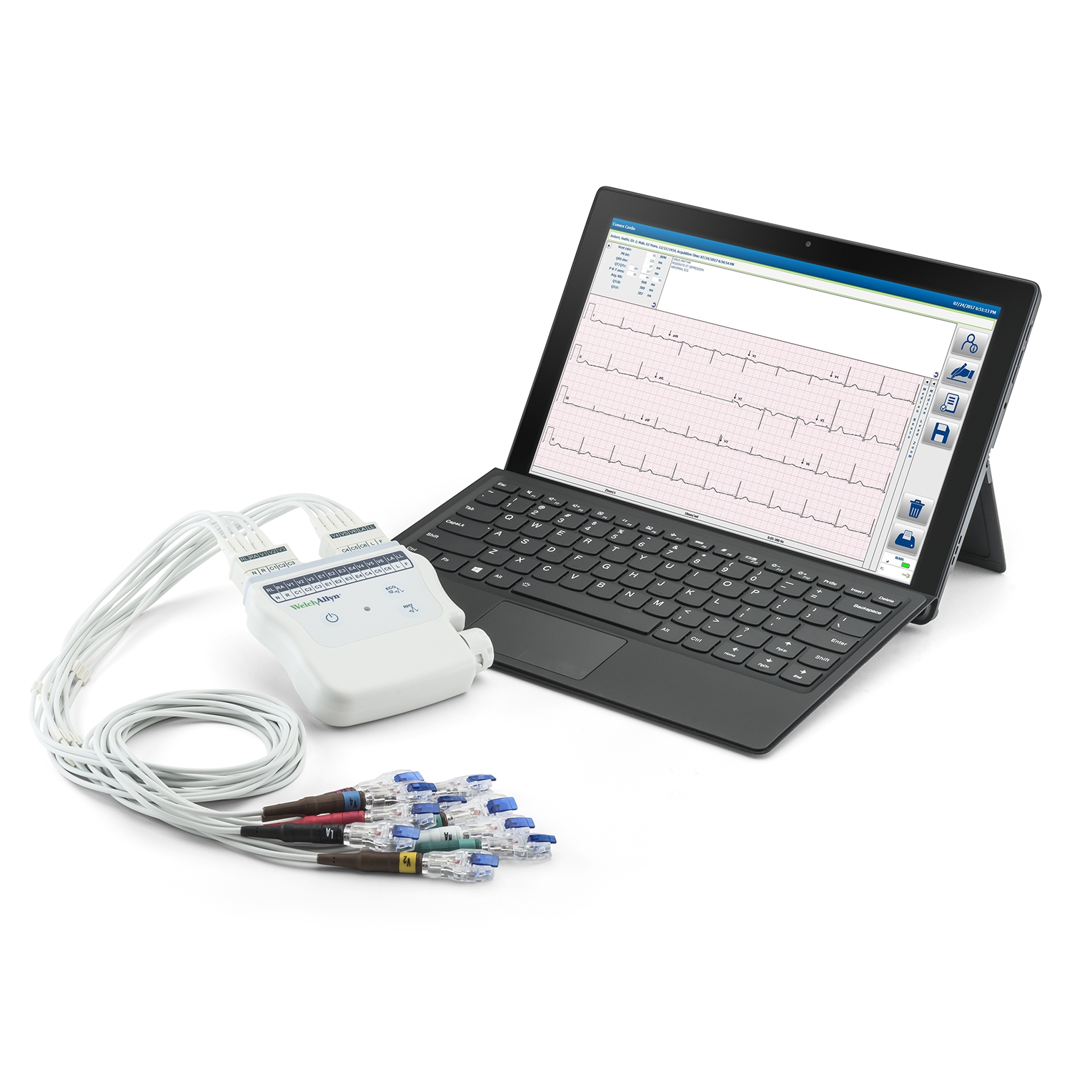 ECG Mortara module logiciel RScribe PC-based version 7