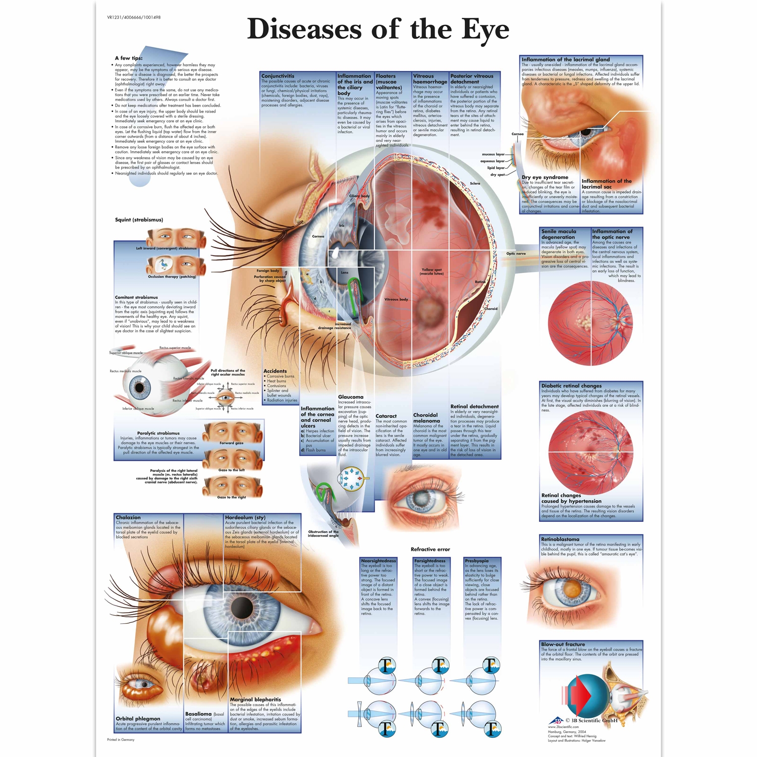 Pancarte murale plastifiée Diseases of the Eye - 50 x 67 cm