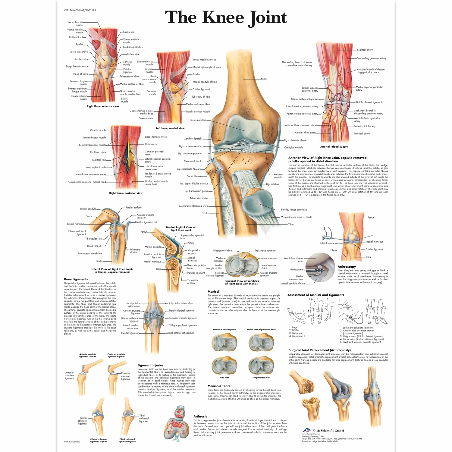 Wandplaat geplastificeerd The Knee Joint - 50 x 67 cm