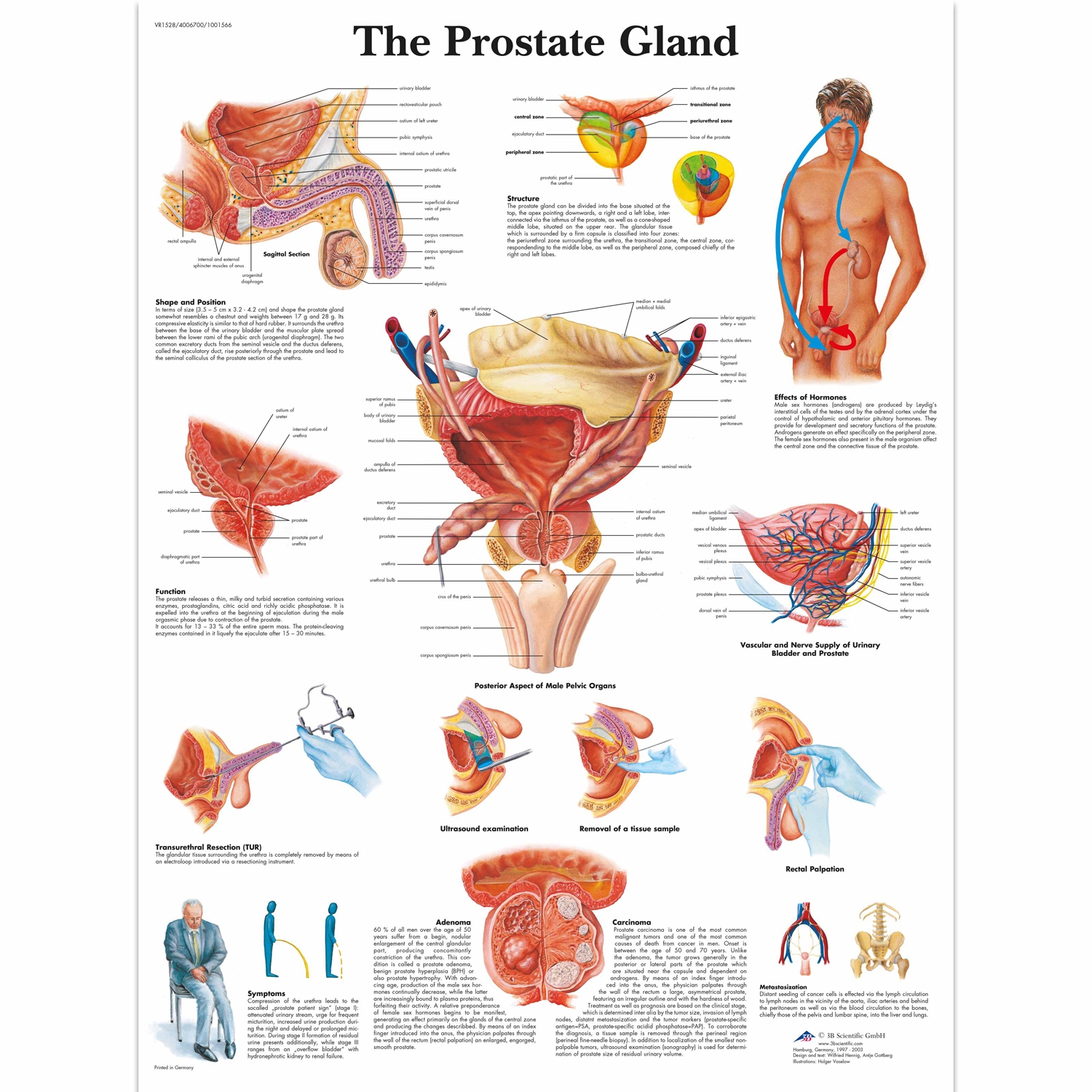 Pancarte murale plastifiée The Prostate Gland - 50 x 67 cm