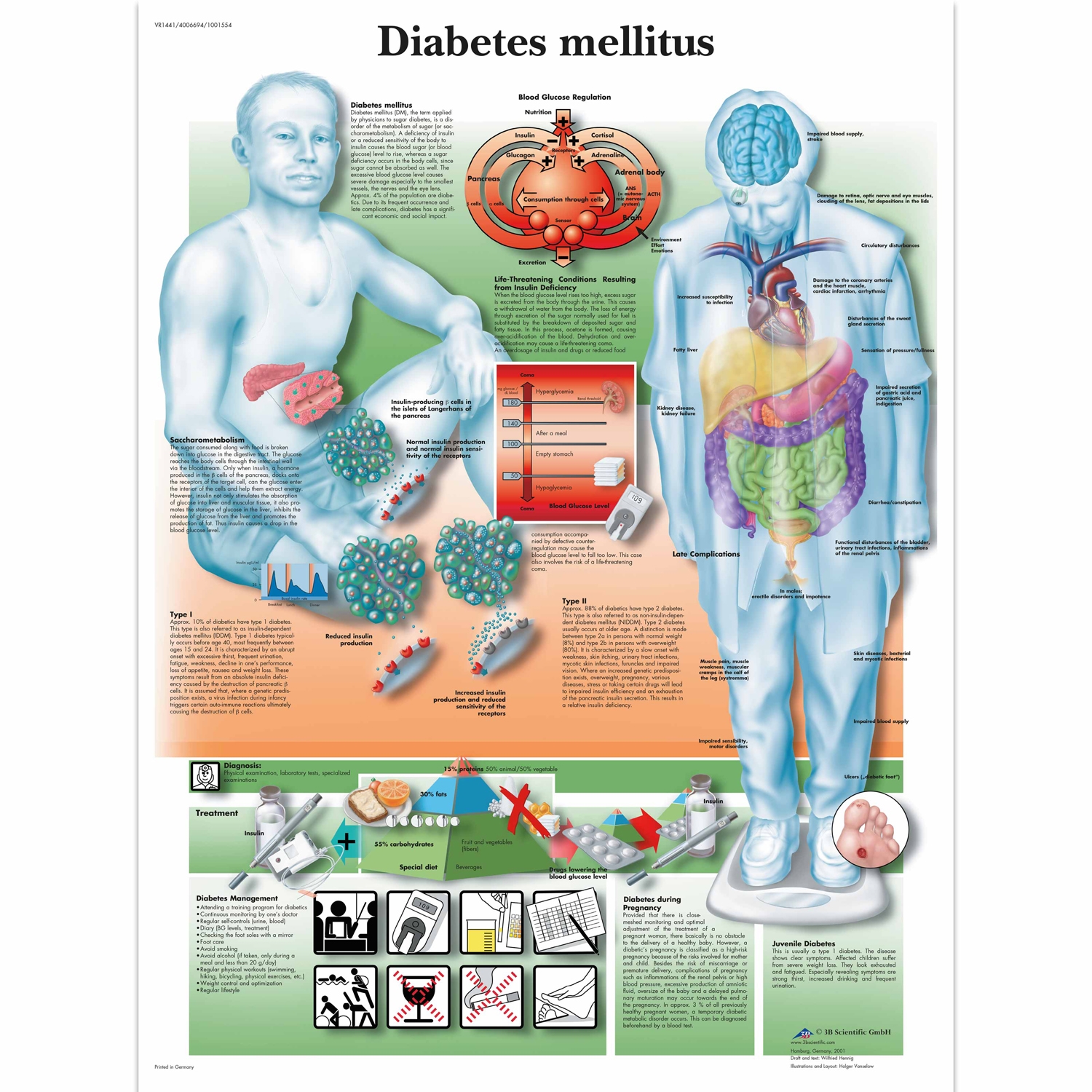 Wandplaat geplastificeerd Diabetesmellitus - 50 x 67 cm