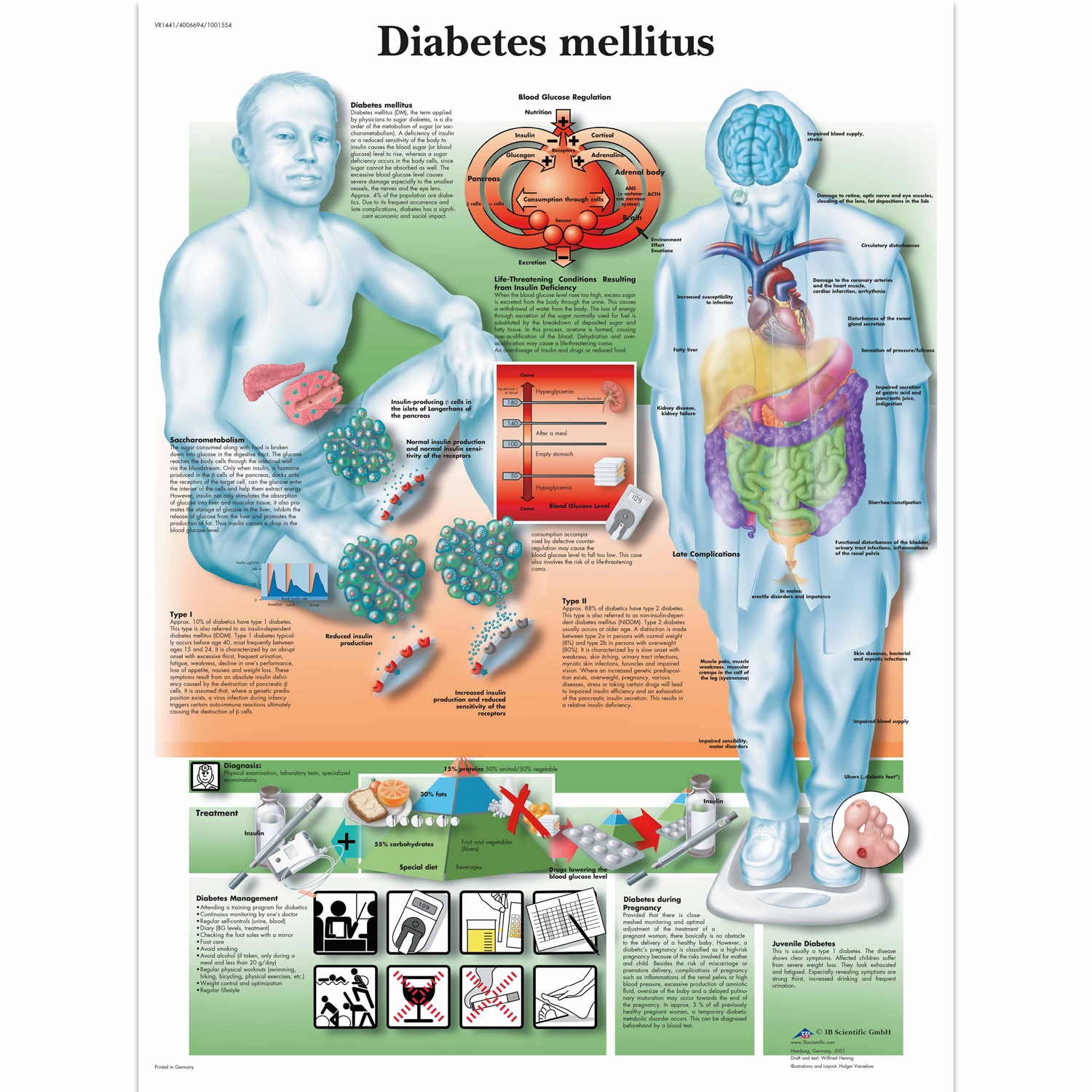 Pancarte murale plastifiée Diabetesmellitus - 50 x 67 cm