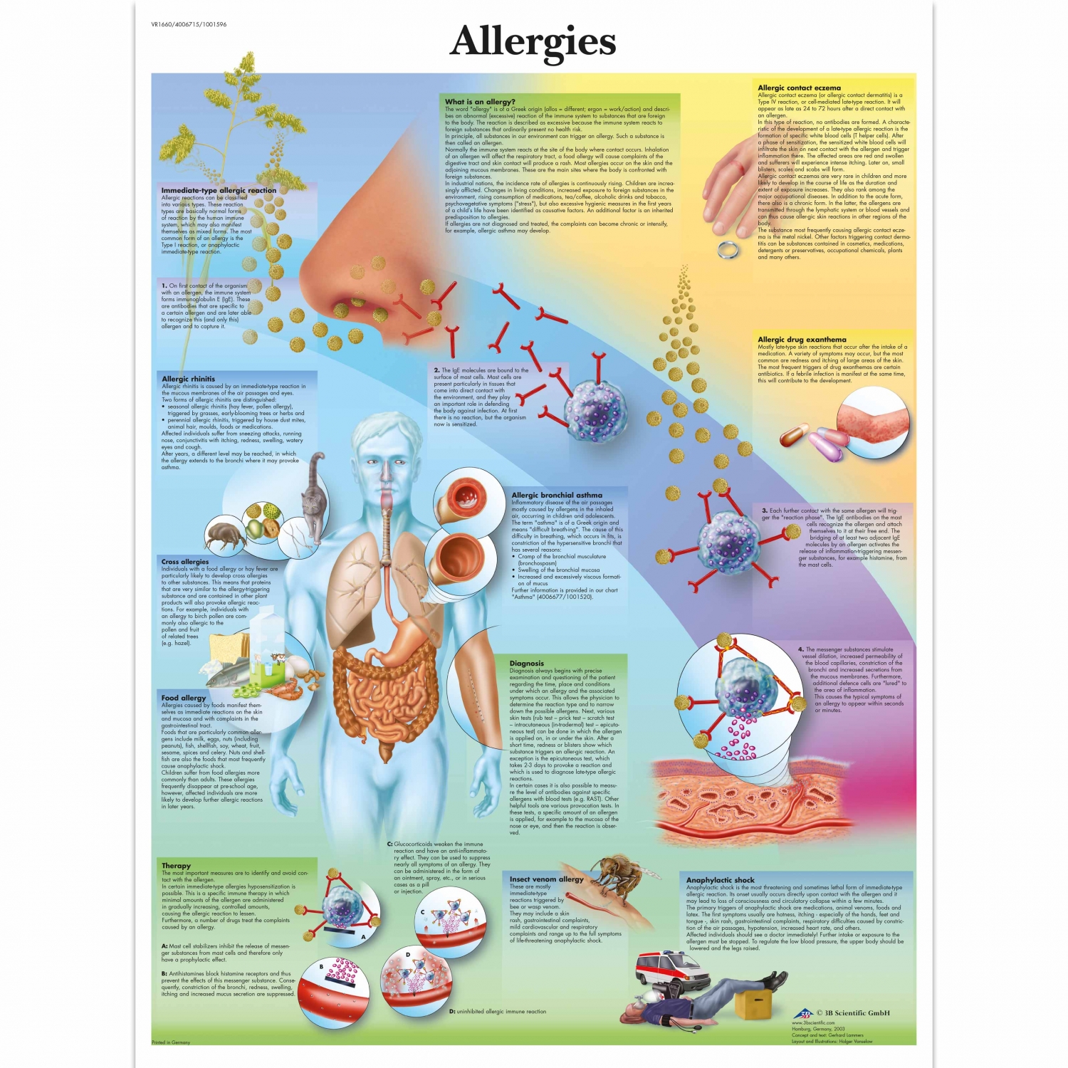 Pancarte murale plastifiée Allergies - 50 x 67 cm
