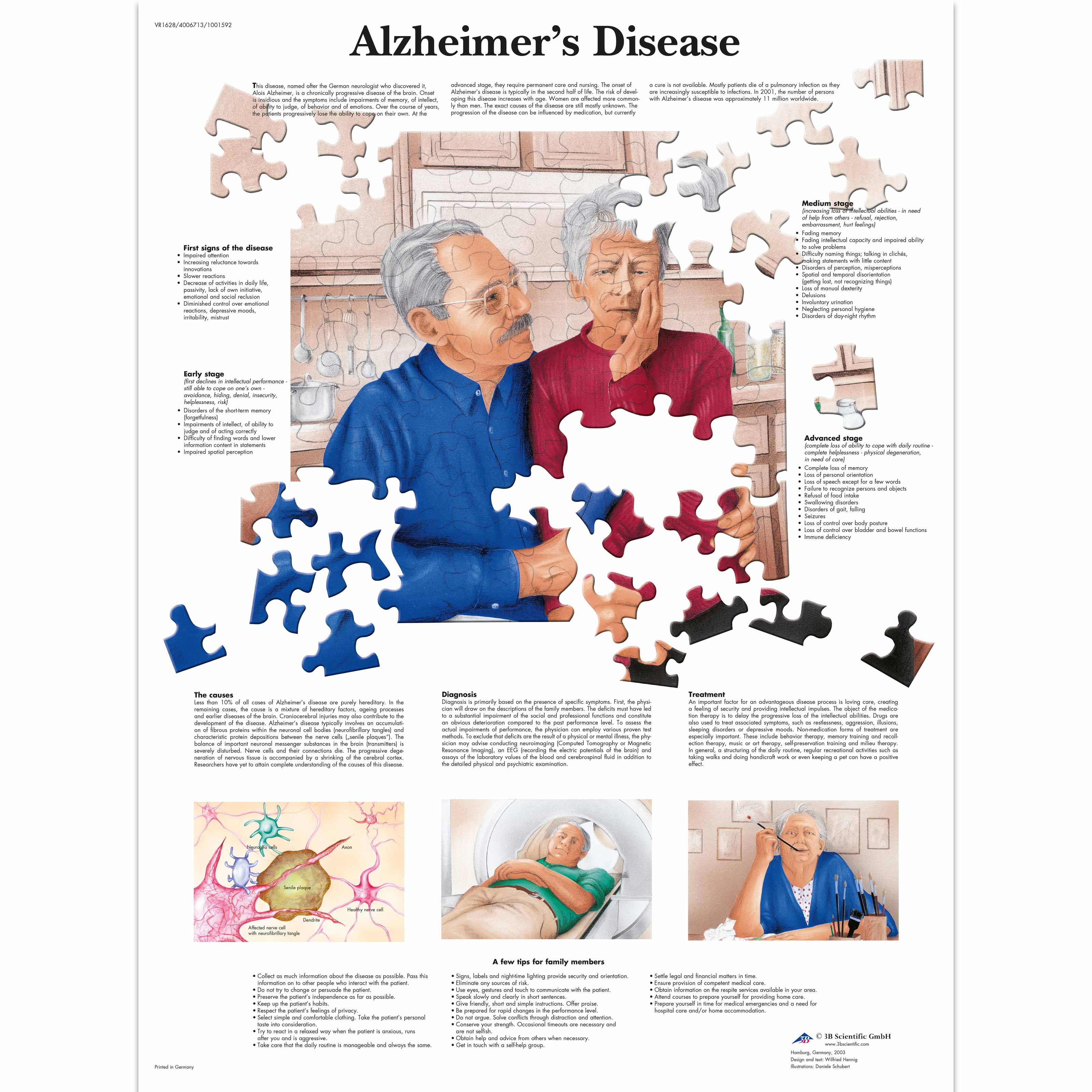 Pancarte murale plastifiée Alzheimer's Disease - 50 x 67 cm