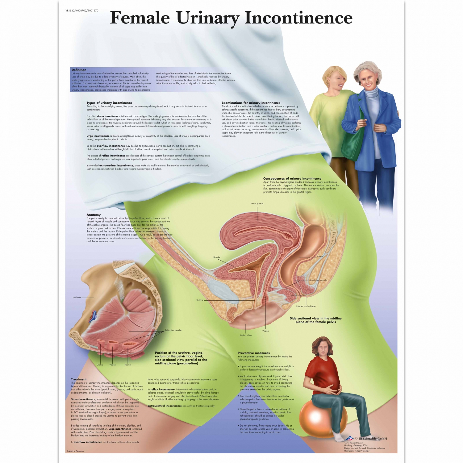 Wandplaat geplastificeerd Female Urinary Incontinence - 50 x 67 cm
